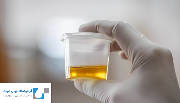 آزمایش ادرار چیست