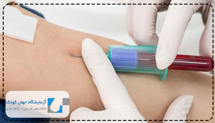 آزمایش قند خون