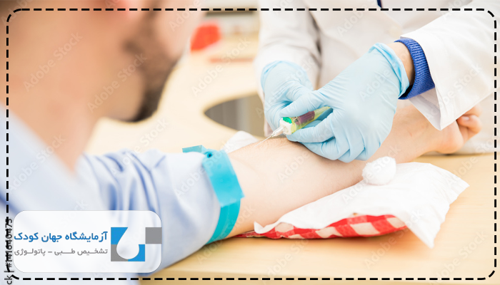 آزمایش چربی خون از چه سنی اهمیت دارد