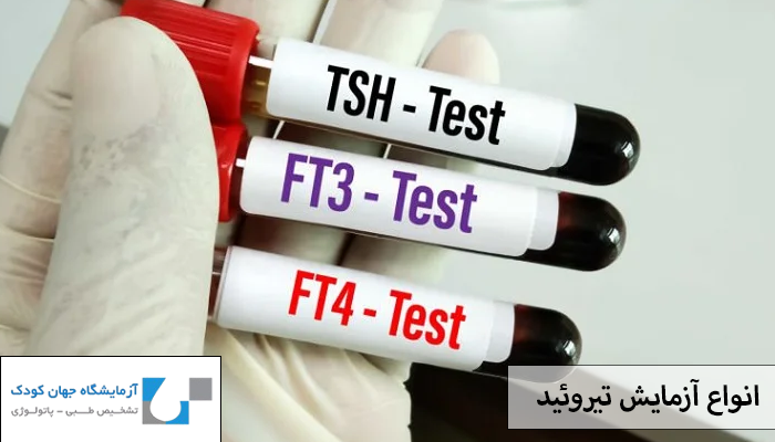 انواع آزمایش تیروئید