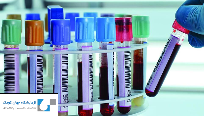 انواع هومون