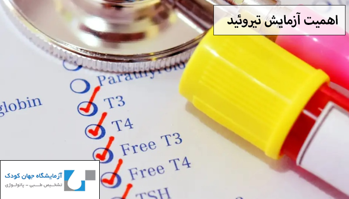 اهمیت انجام آزمایش تیروئید