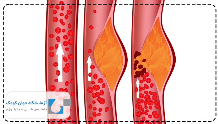بهترین سن آزمایش چربی