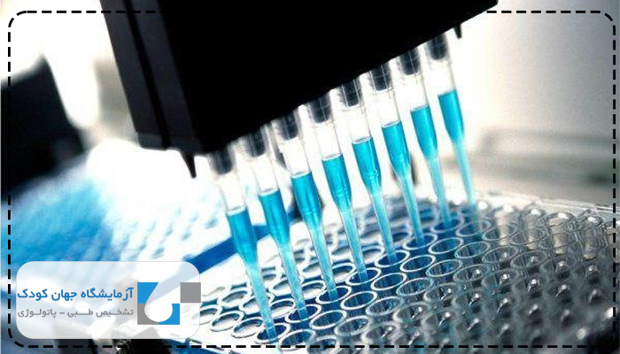 تست ژنتیک برای صرع