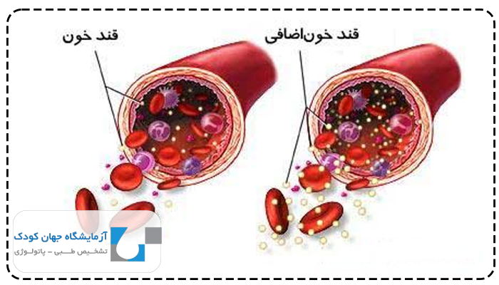 تفسیر آزمایش قند خون