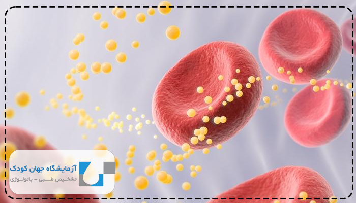 زمان انجام آزمایش چربی