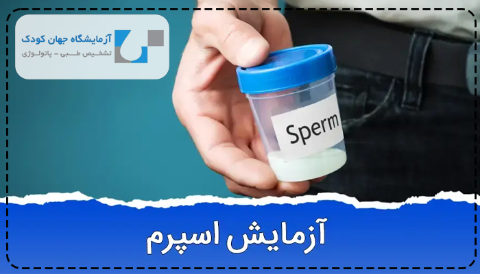 آزمایش اسپرم