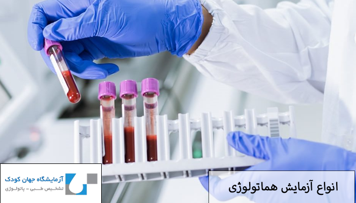 انواع آزمایش هماتولوژی