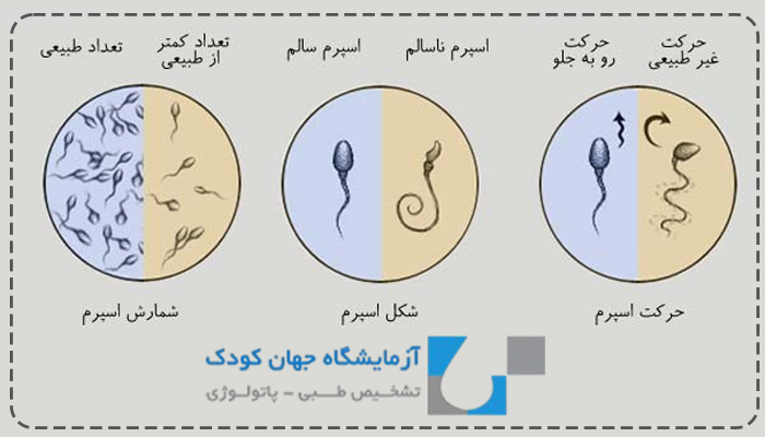 تست اسپرموگرام