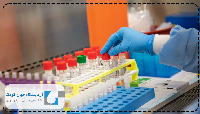 آزمایش قند خون قبل از بارداری