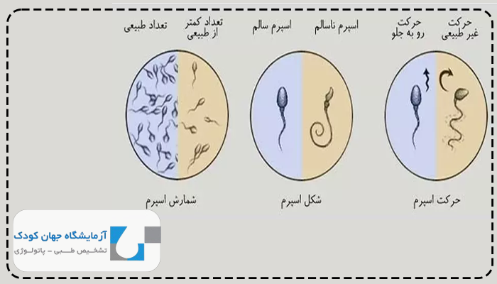 آزمایش‌ اسپرم قبل از بارداری برای مرد