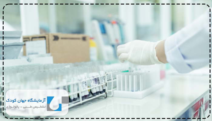 آزمایش قبل ازدواج