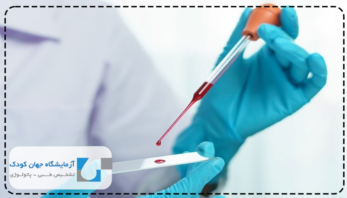 آزمایش چکاپ کامل سالانه