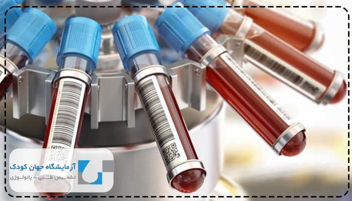 تست های بعد از زایمان