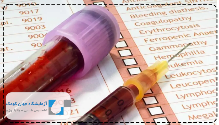 تفسیر آزمایش لوپوس آنتی کواگولانت