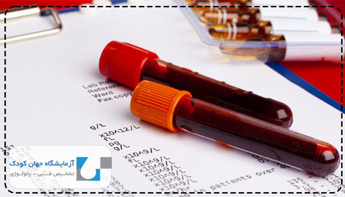 تفسیر جواب آزمایش لوپوس