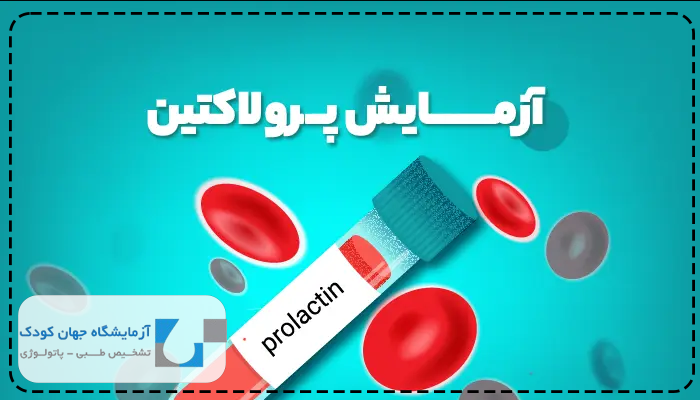 تفسیر نتایج آزمایش پرولاکتین