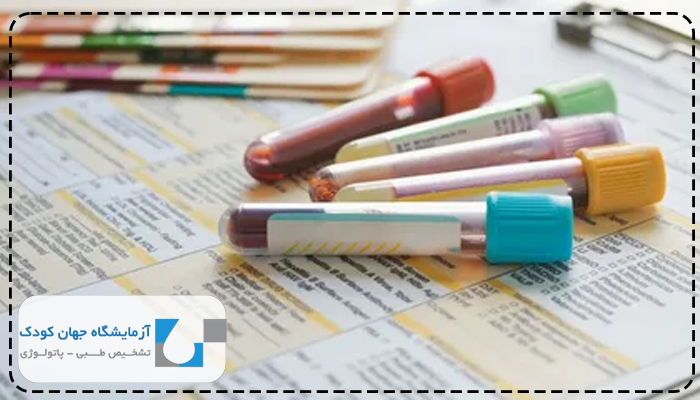 رنج نرمال آزمایش لوپوس