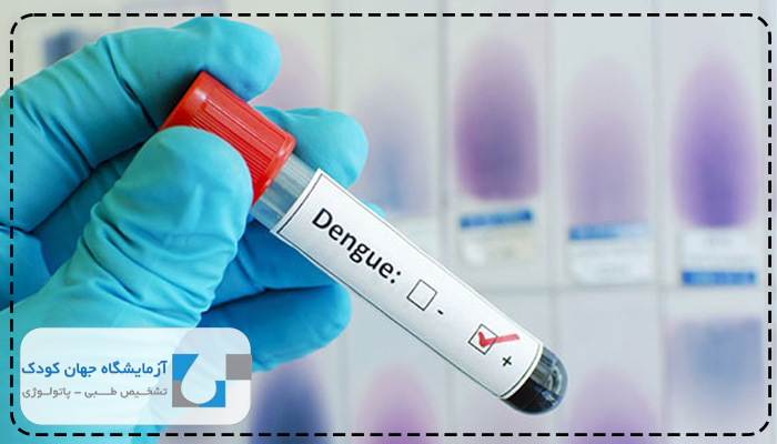 نحوه انجام آزمایش اعتیاد