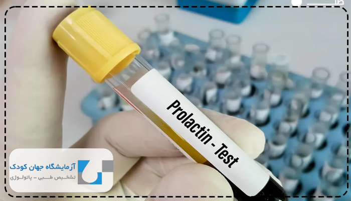 کاربرد آزمایش پرولاکتین
