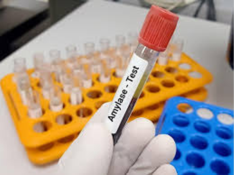 Amylase آزمایش