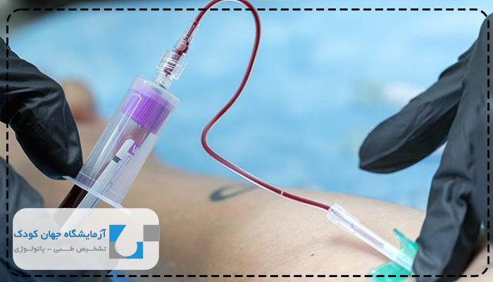 lactate در آزمایش خون چیست