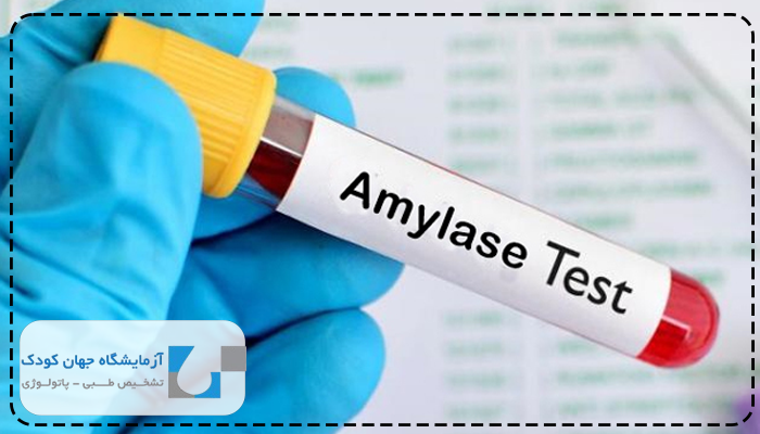 آزمایش آمیلاز test