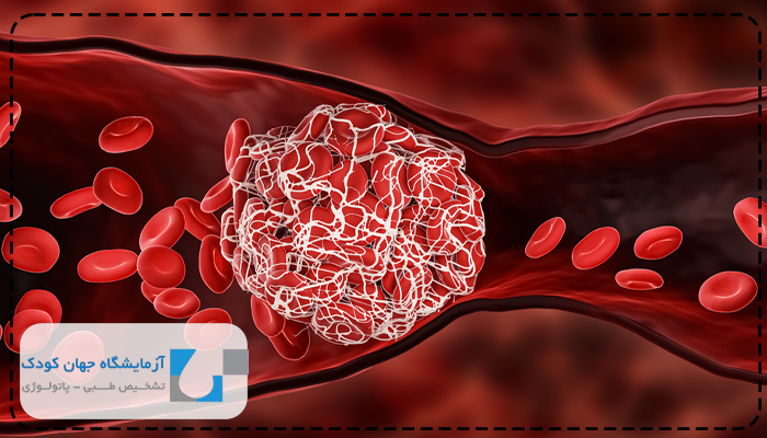 آزمایش دی دایمر لخته خون