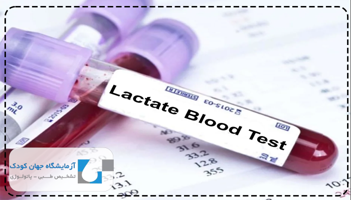 آزمایش لاکتات Lactate