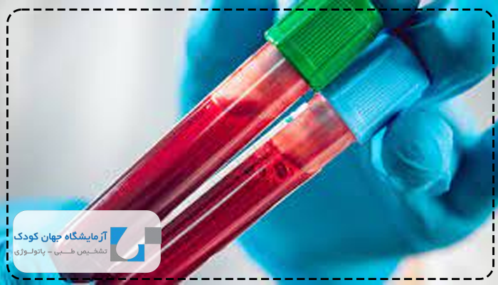 آزمایش لنفوسیت چیست؟