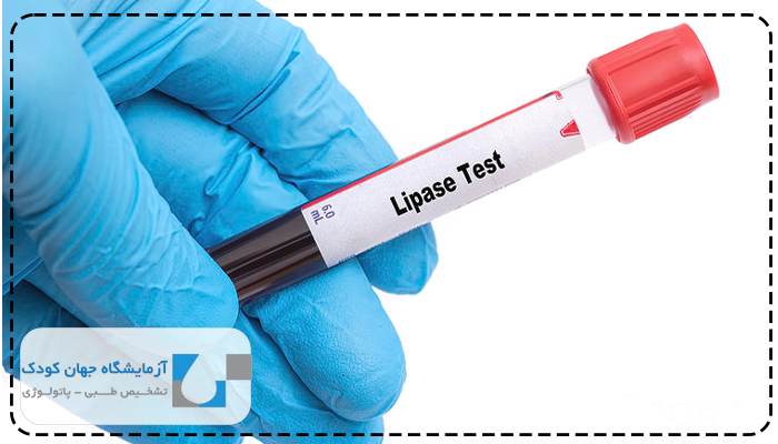 آزمایش پانکراس چیست