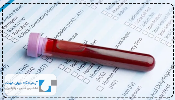 آمیلاز بالا نشانه چیست