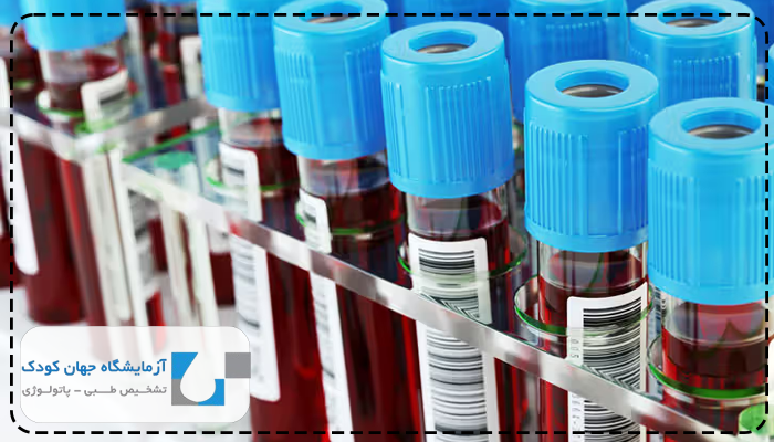 آمیلاز بالا نشانه چیست