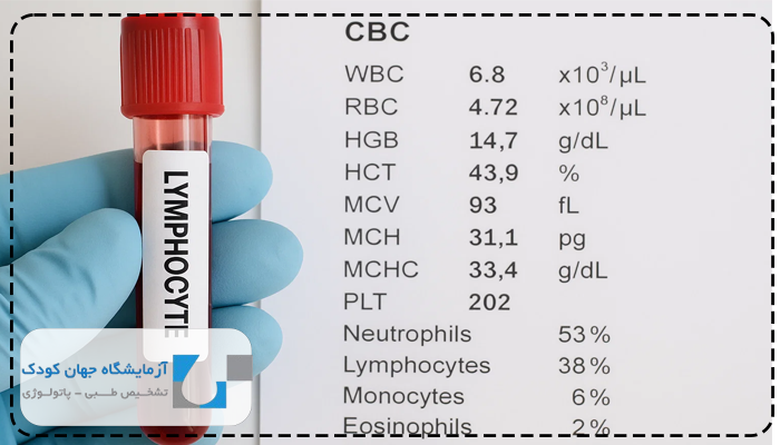لنفوسیت بالا نشانه چیست