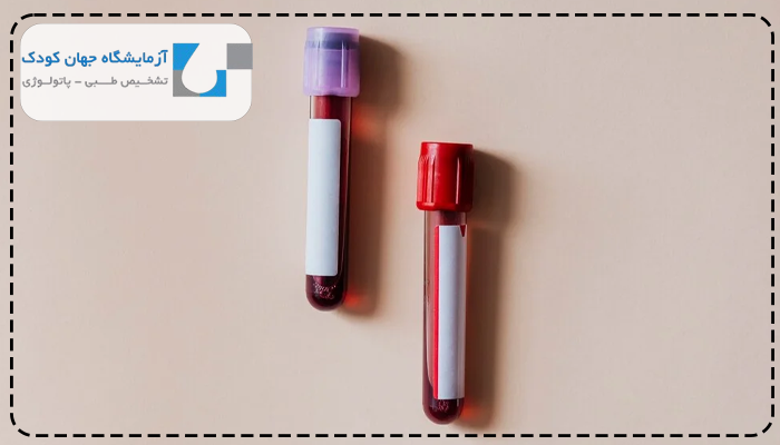 کمبود پیروات کیناز در کم خونی