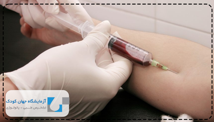 آزمایش ایدز بعد از 6 هفته