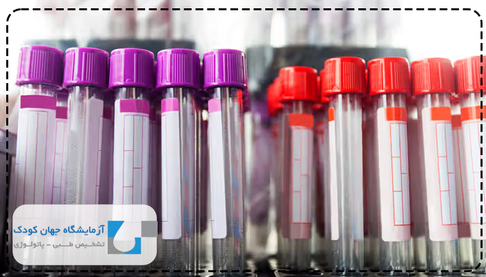 آزمایش کراتین خون ناشتا