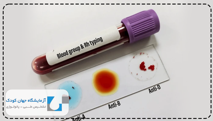 آزمایش گروه خونی باید ناشتا بود