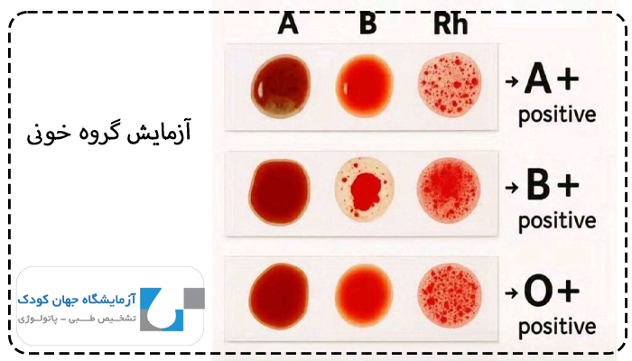 آزمایش گروه خونی برای گواهینامه باید ناشتا بود