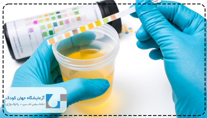 آزمایش گلوکز ادرار