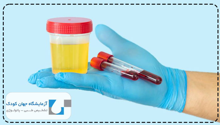 ایا قند در ادرار خطرناک است