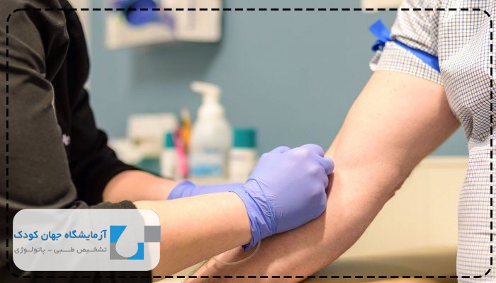 تفسیر آزمایش لام خون محیطی