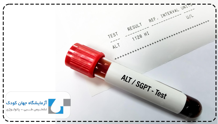تفسیر آزمایش کبد