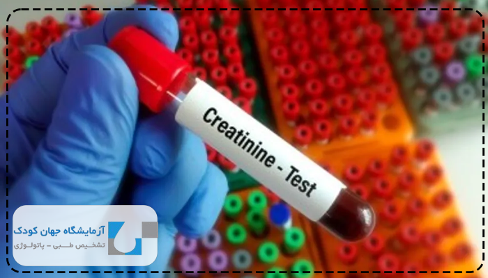 تفسیر آزمایش کراتین