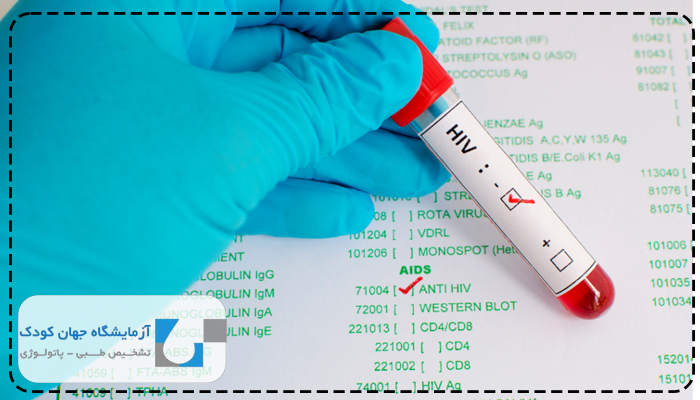عکس جواب ازمایش ایدز منفی