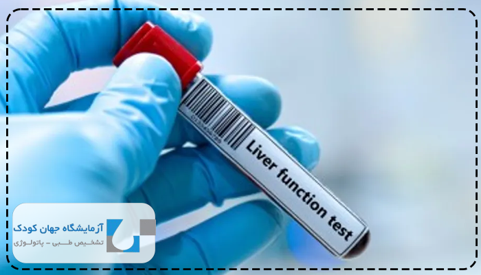 گرید کبد چرب در آزمایش خون