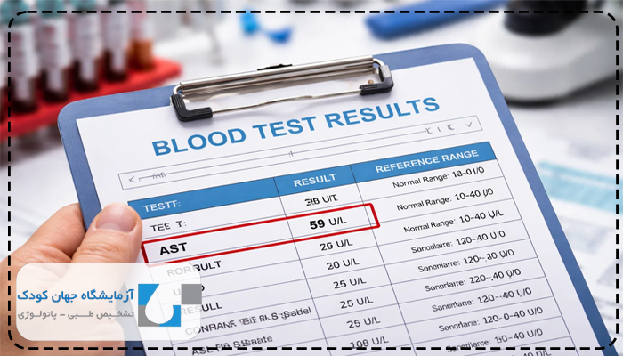 آزمایش ast باید چند باشد