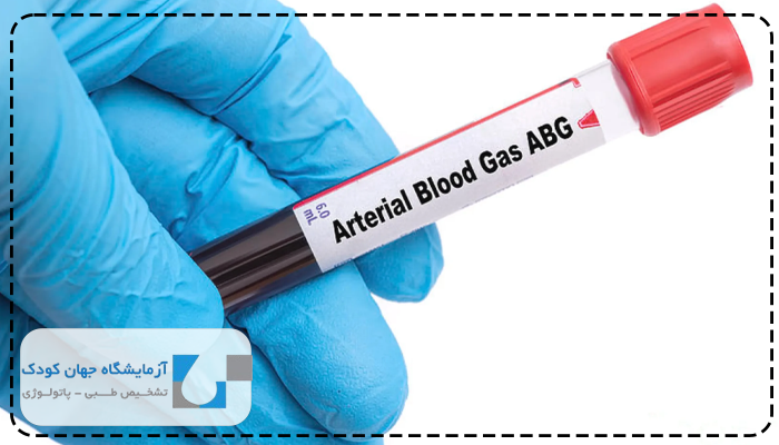 آزمایش گازهای خونی