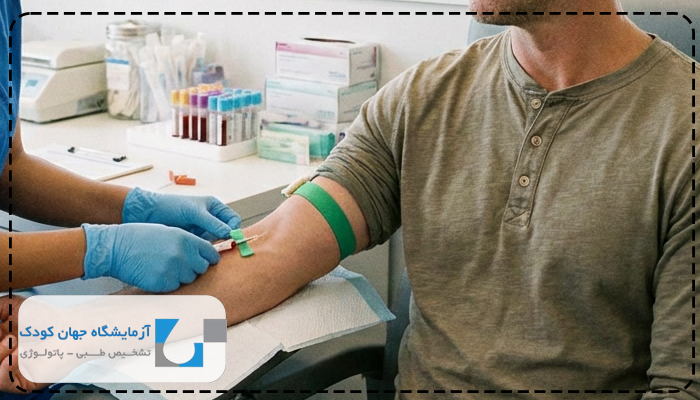 بالا بودن انزیم گاما جی تی