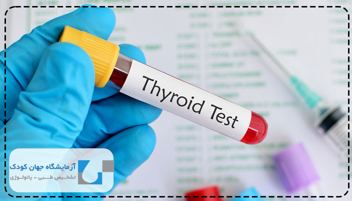 تست تیروئید